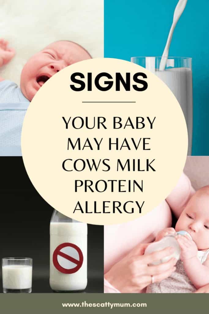 baby allergic reaction to milk